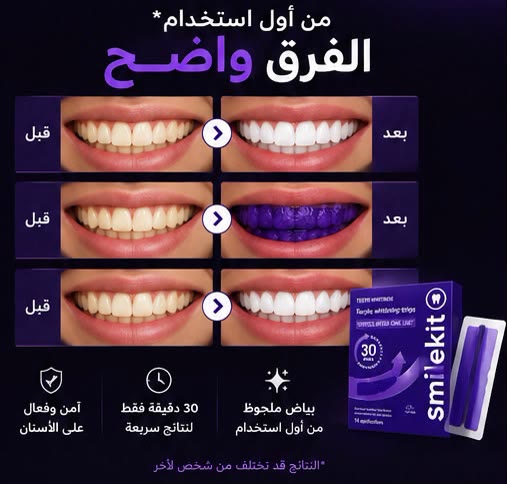 SmileKit teeth whitening before and after image ad